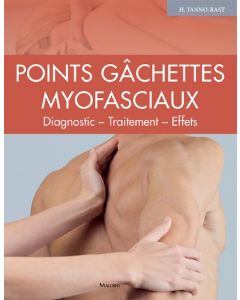 Points gâchettes myofasciaux