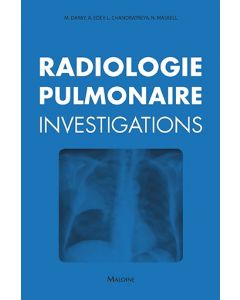 Radiologie pulmonaire : investigations